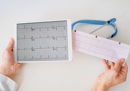 Arrhythmia Management